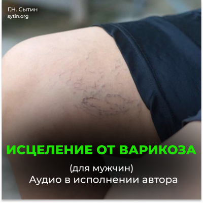 Healing from varicose veins. Healthy legs. Healing from foot swelling (male) - Online Disk Healing from varicose veins. Healthy legs. Healing from foot swelling (male) - Online Disk